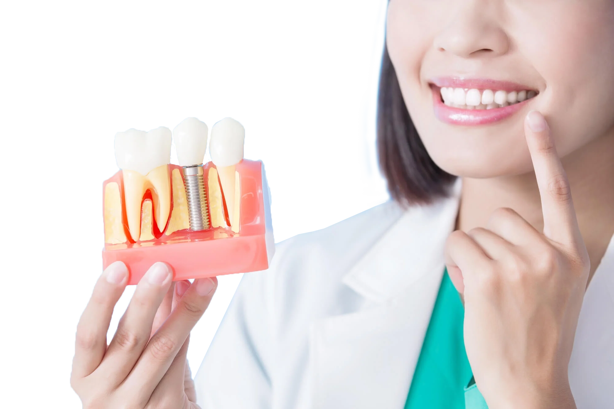 Implant Tedavileri